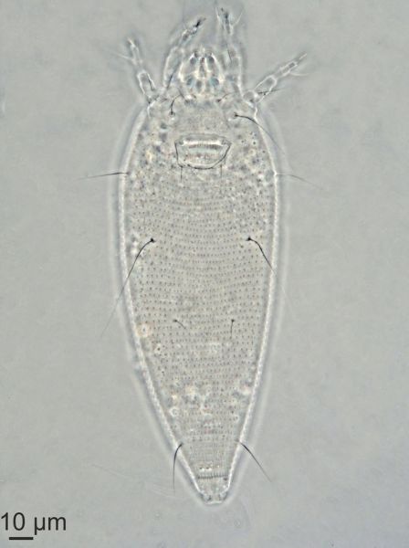 New mud dragons from Svalbard: three new species of Cristaphyes and the  first Arctic species of Pycnophyes (Kinorhyncha: Allomalorhagida:  Pycnophyidae) [PeerJ]